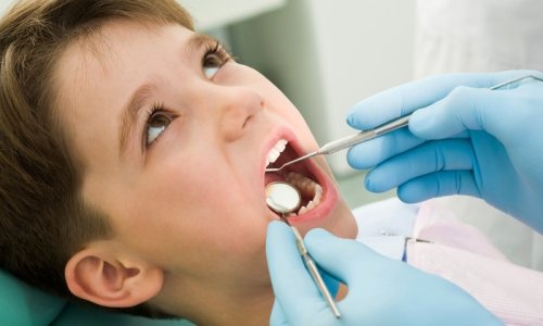 Les dents de lait chez les enfants commencent à tomber dès l'âge de cinq ans.