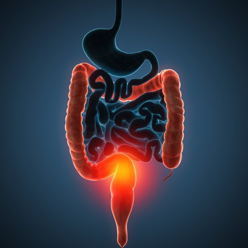 La enfermedad de Crohn en niños puede afectar todo el trasto digestivo.