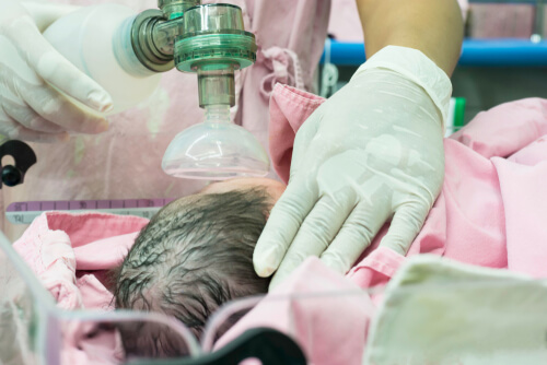 Mise en place d'une assistance respiratoire chez un bébé.
