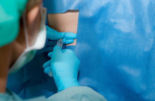 La anestesia raquídea se coloca en la parte lumbar.