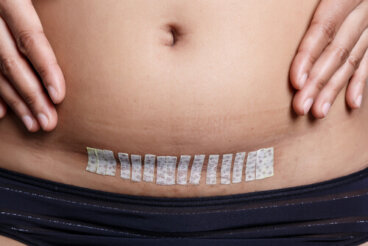 Ser madre tras una histerectomía