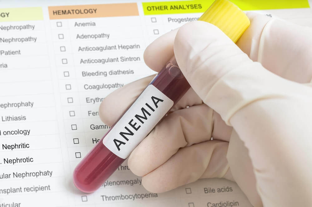 La anemia en niños.