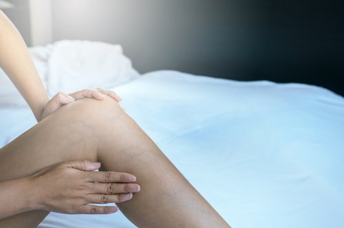 ¿Cómo eliminar las varices durante el embarazo?