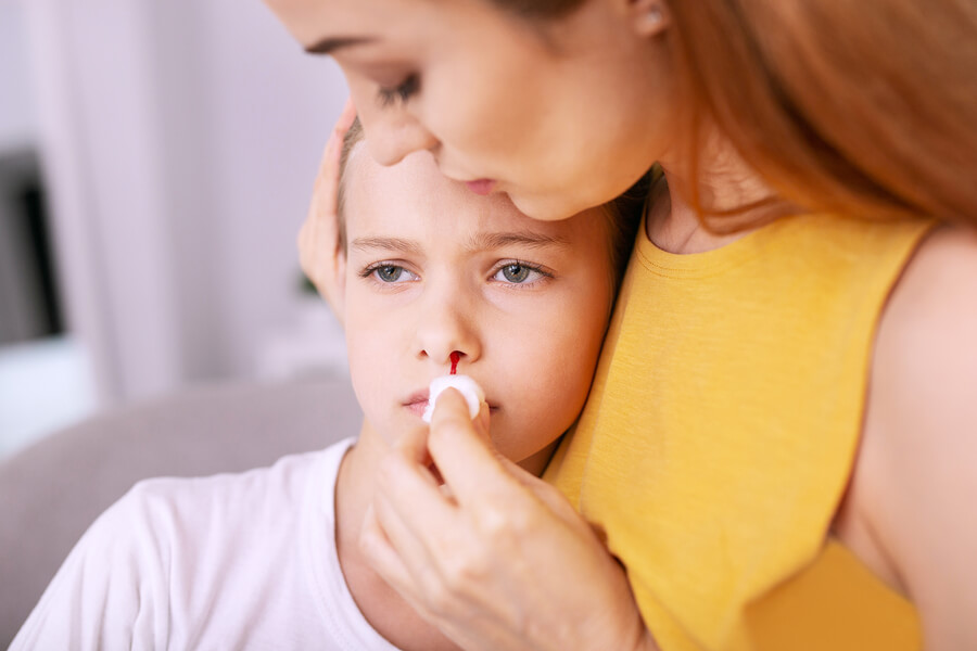 Las hemorragias nasales en niños.