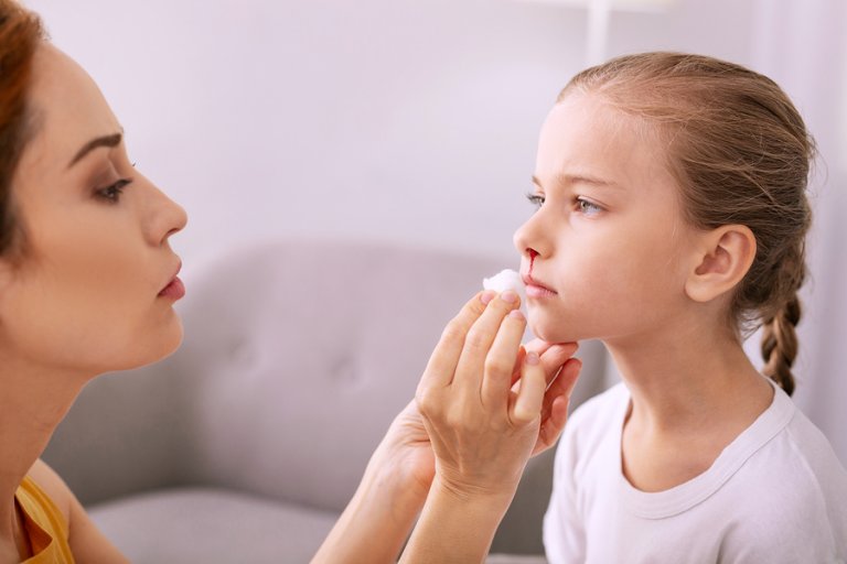 Hemorragias nasales en niños