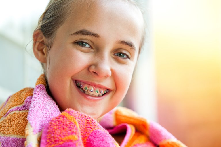 Niños con ortodoncia: ¿cuáles son las recomendaciones?