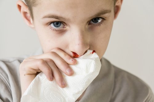 ¿Por qué a mi hijo le sale sangre de la nariz?