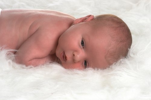 Los cuidados de la piel del recién nacido sirven para evitar problemas como la dermatitis.