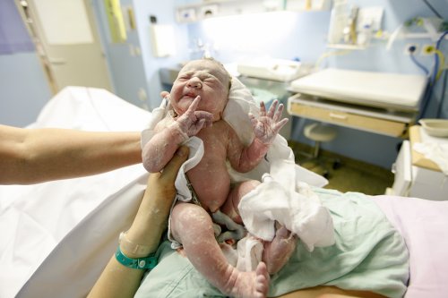 La donación del cordón umbilical después del parto no implica ningún riesgo para el bebé.