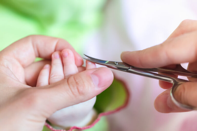 Uñas encarnadas en bebés