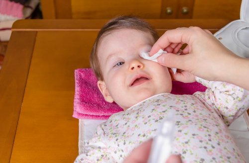 Conjuntivitis en bebés, ¿cómo tratarla?