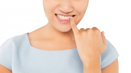 ¿Por qué los dientes cambian de color?