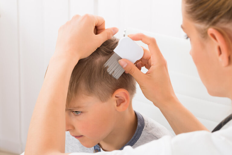 4 remedios contra la psoriasis en niños