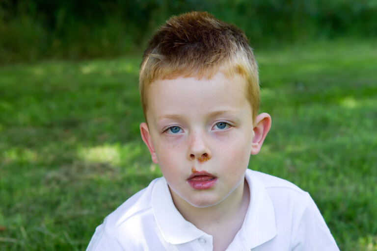 El impétigo contagioso en los niños