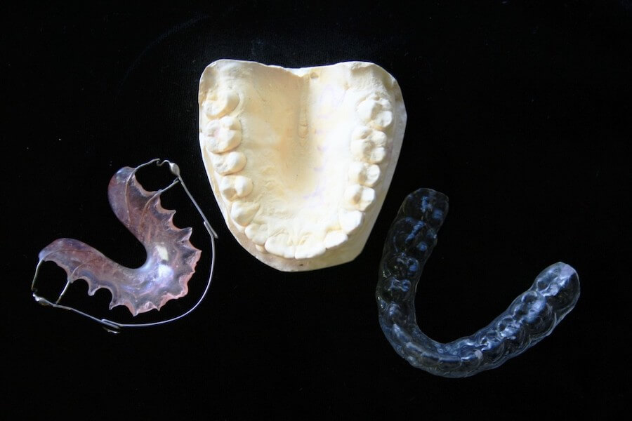 tipos-de-ortodoncia
