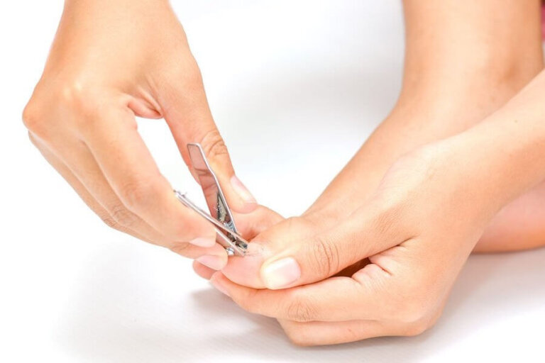 ¿Cómo curar las uñas encarnadas?