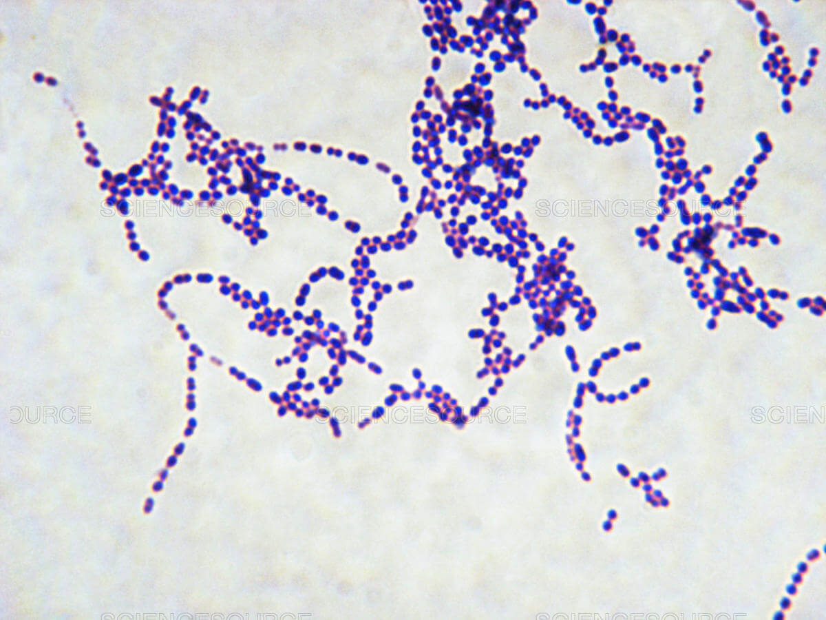 Bacteria: Streptococcus pyogenes.