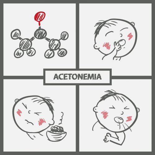 Vómitos, inapetencia y ansiedad son algunos de los síntomas de la acetona en niños