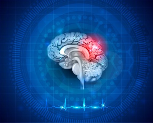 ¿Qué es el daño cerebral adquirido?