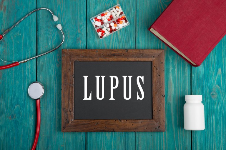 Lupus sistémico en niños