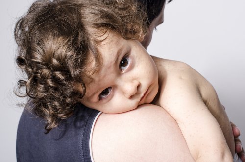Dermatomiositis infantil.