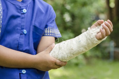 Niño con el brazo escayolado debido a una lesión deportiva y con signos posibles de tener artrosis infantil.