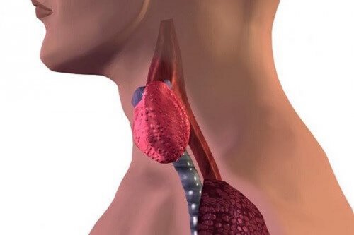 Tiroiditis de Hashimoto en niños
