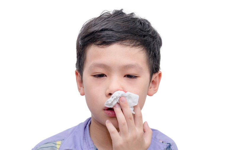A mi hijo le sangra mucho la nariz, ¿qué debo hacer?