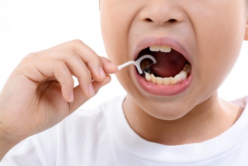 Fluorosis dental en niños.