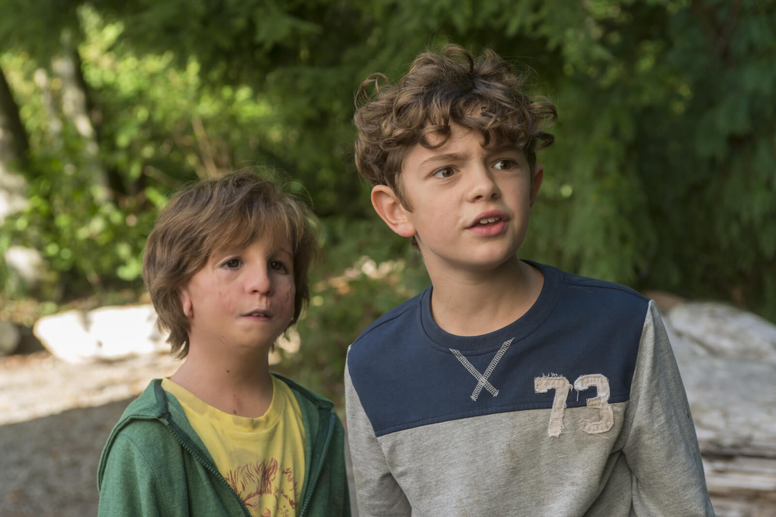 Enfant atteint du syndrome de Treacher Collins.