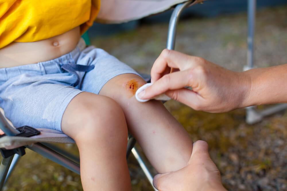 En person som rengör ett sår på ett barns knä.