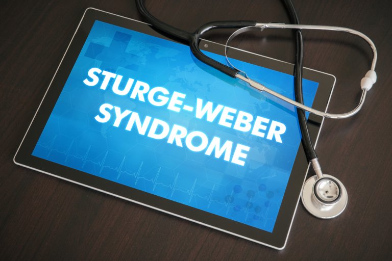 Síndrome de Sturge Weber en niños