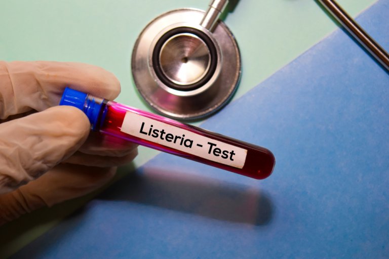 Listeriosis neonatal: una enfermedad a considerar