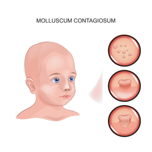 Dibujo de un niño con moluscos.