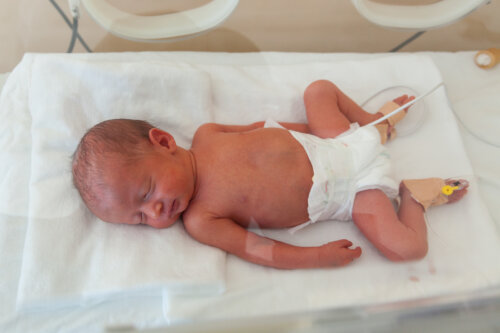 Bebé prematuro en la incubadora con problemas digestivos.