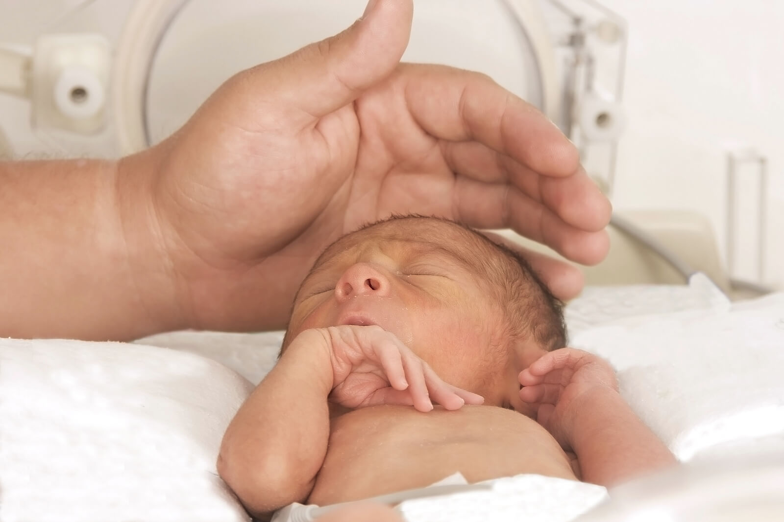 Bebé prematuro en la incubadora con síndrome de dificultad respiratoria neonatal.