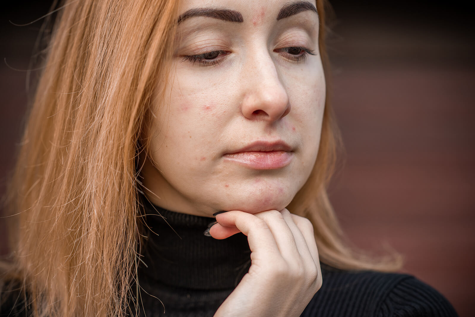 Une jeune adolescente avec de l'acné sur le visage.