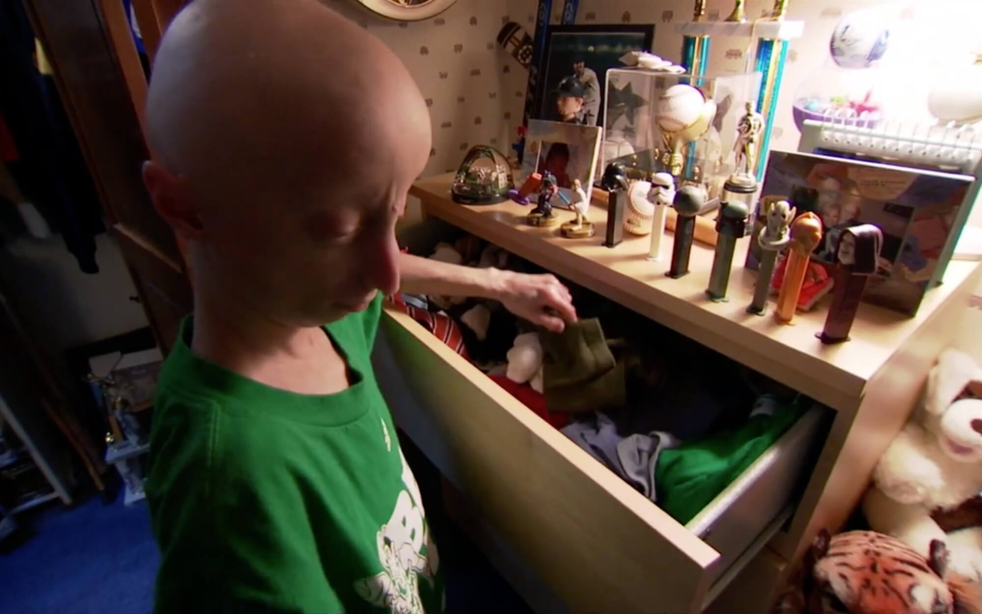 Imagen extraída del documental sobre el síndrome de progeria.