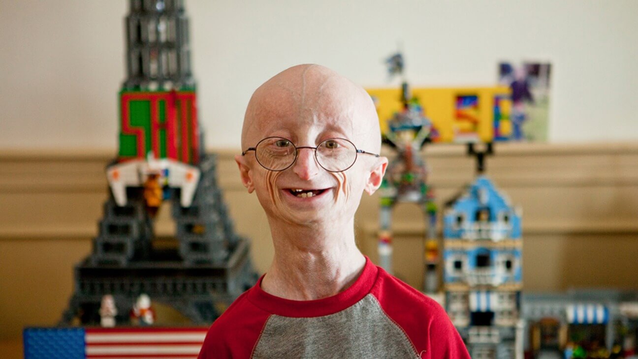 Life According to Sam, documental sobre el síndrome de progeria.