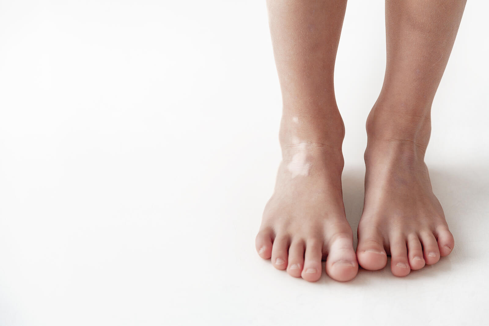 Pieds avec des taches blanches.