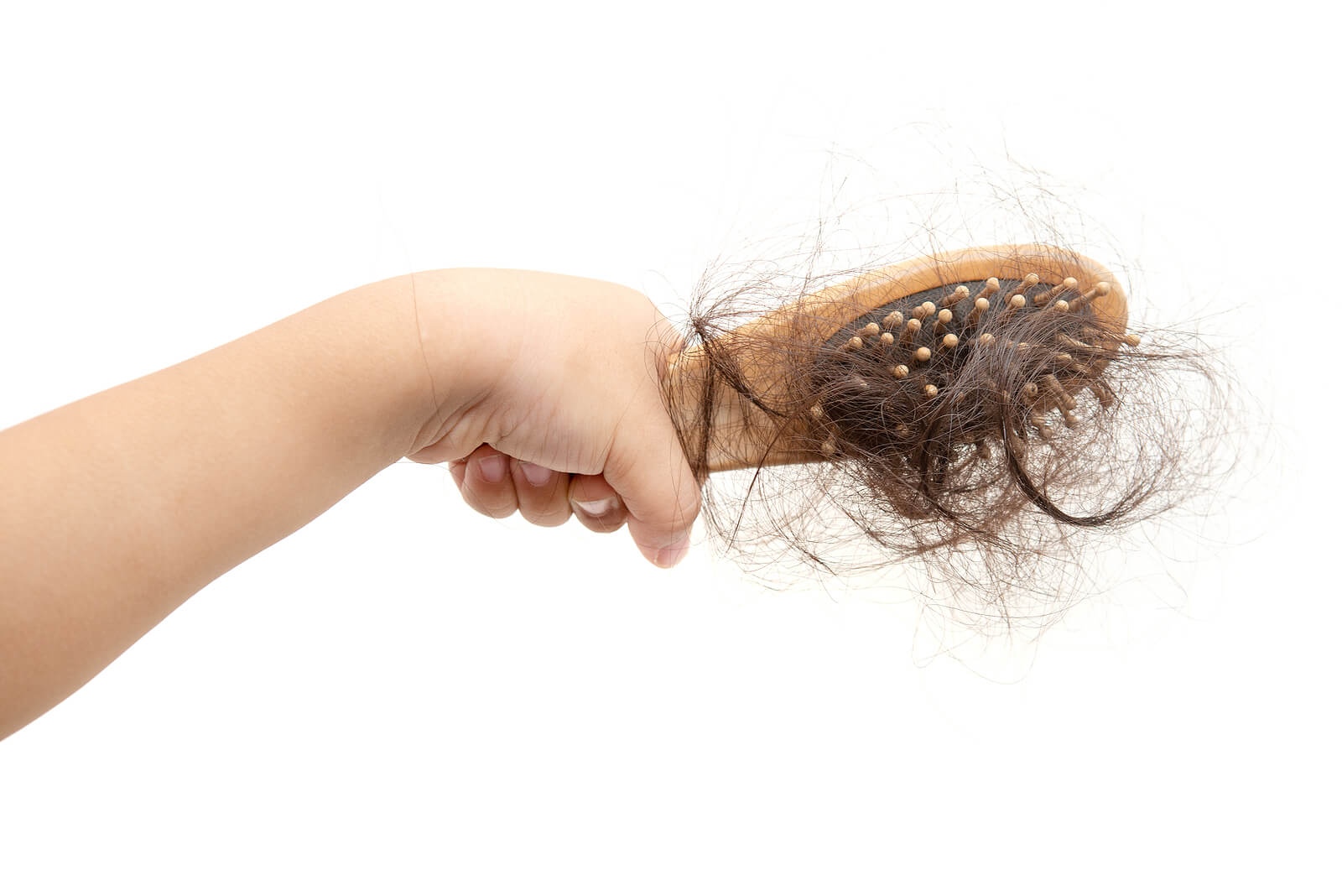 Cepillo leno de mechones debido a la alopecia en niños.