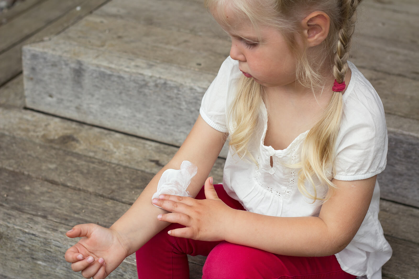 Las mejores cremas para la dermatitis atópica en niños
