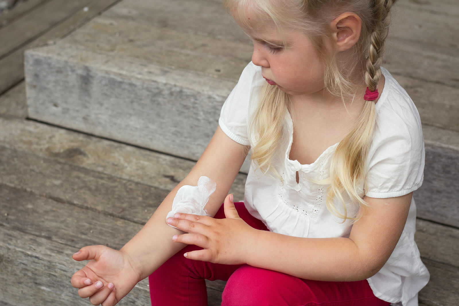 Fille appliquant des crèmes pour la dermatite atopique.