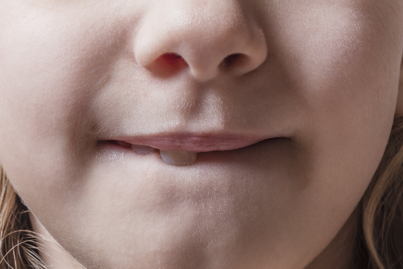 10 señales de que tu hijo necesita ortodoncia