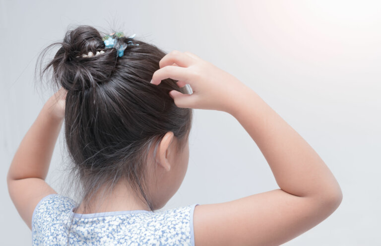 Alopecia en niños: síntomas, causas y tratamiento