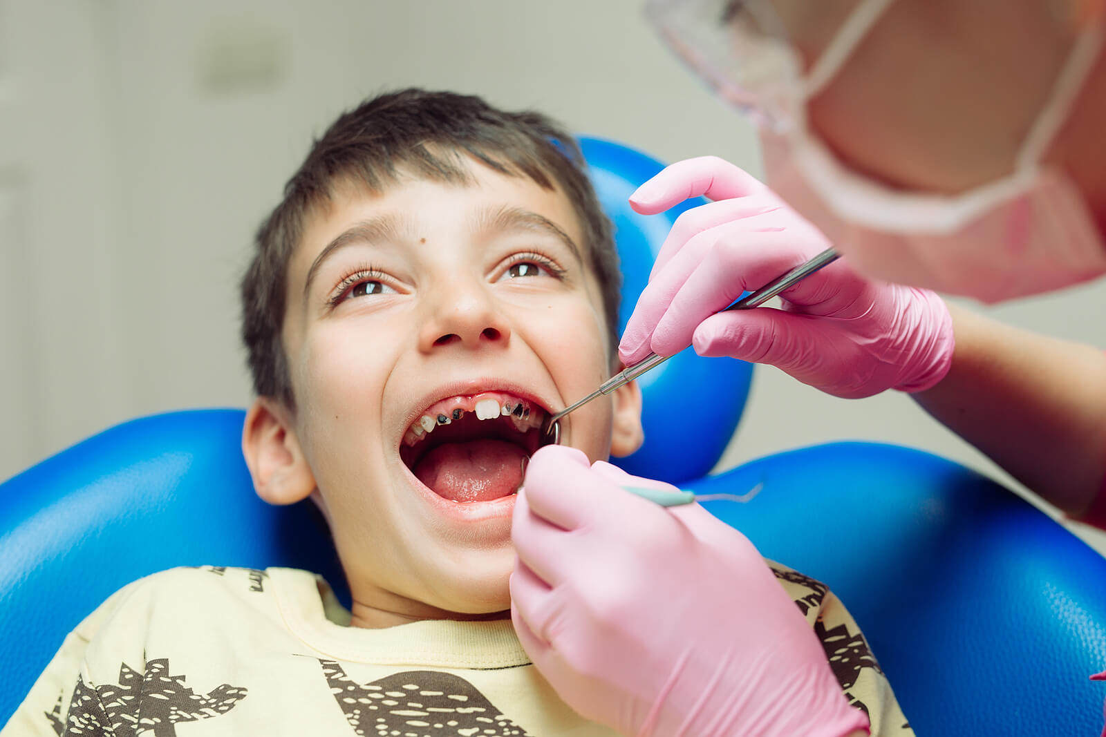 En tannlege som jobber med tennene til et barn med store hull.