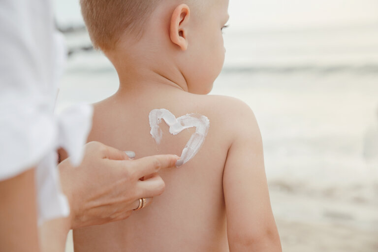 Protección de la piel en niños con cáncer