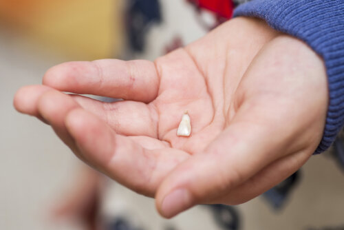 Avulsión dental en niños: qué es y cómo actuar