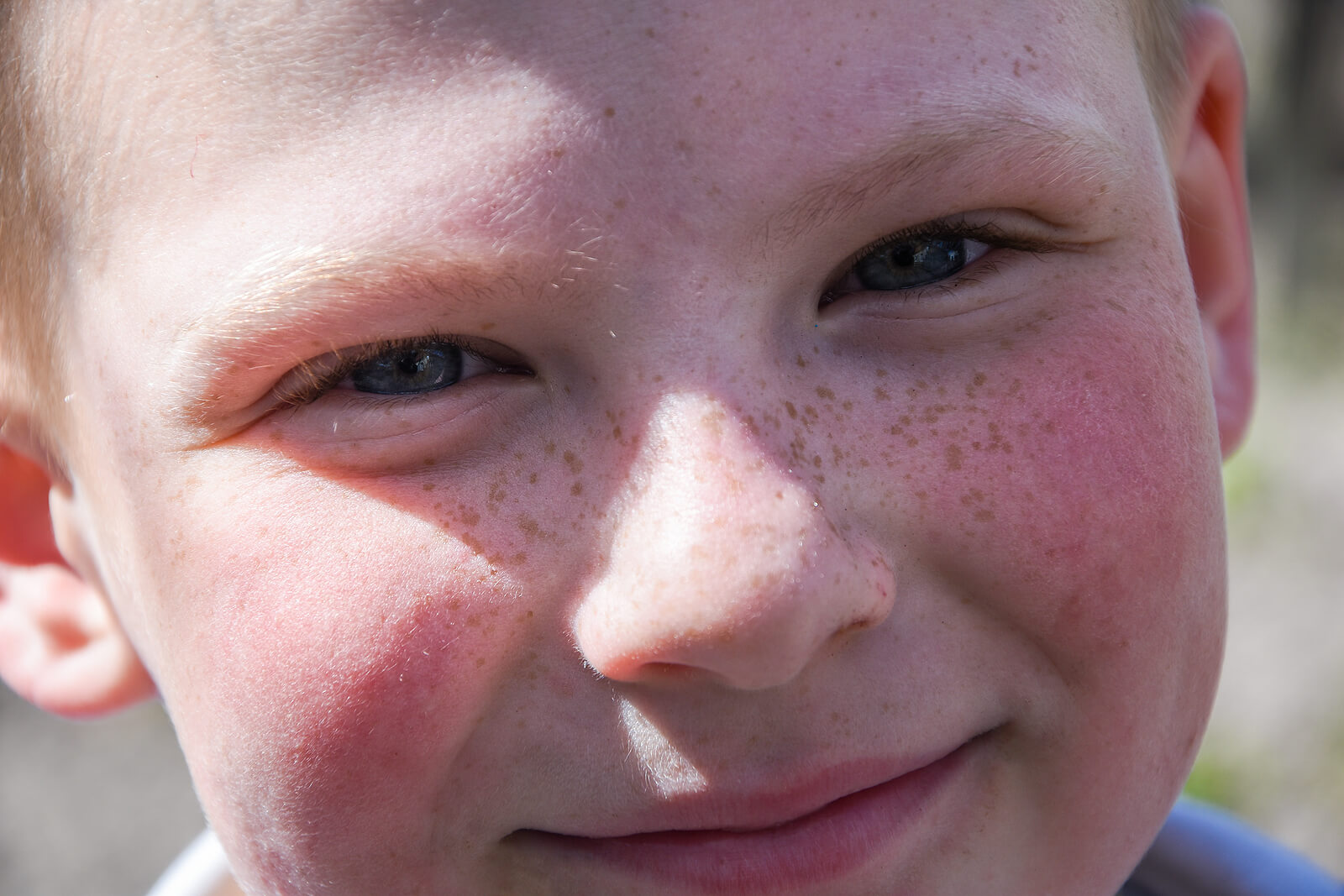 A young boy with freckles and pink cheeks.