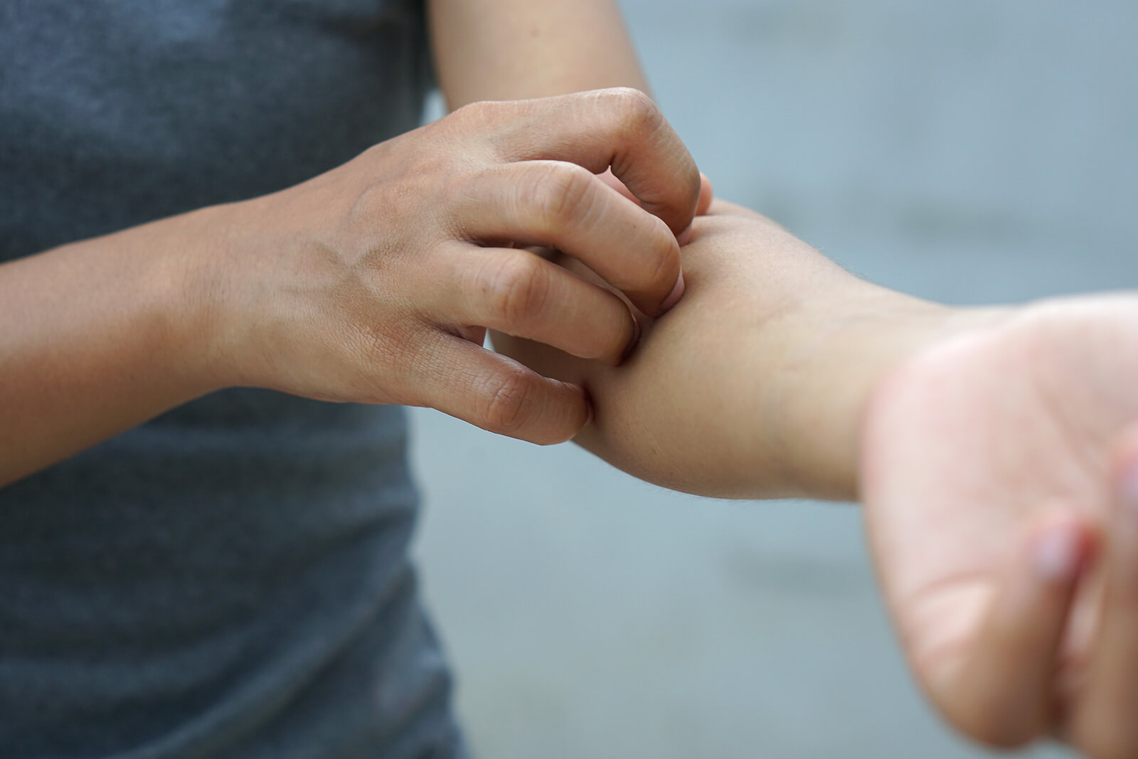 Mujer con pico porque tiene infecciones en la piel.